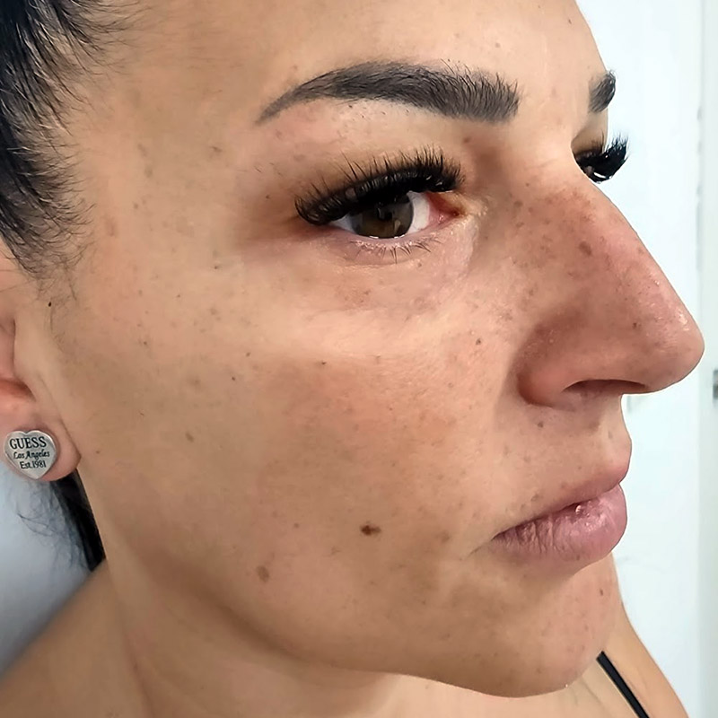 hidratacion facial antes